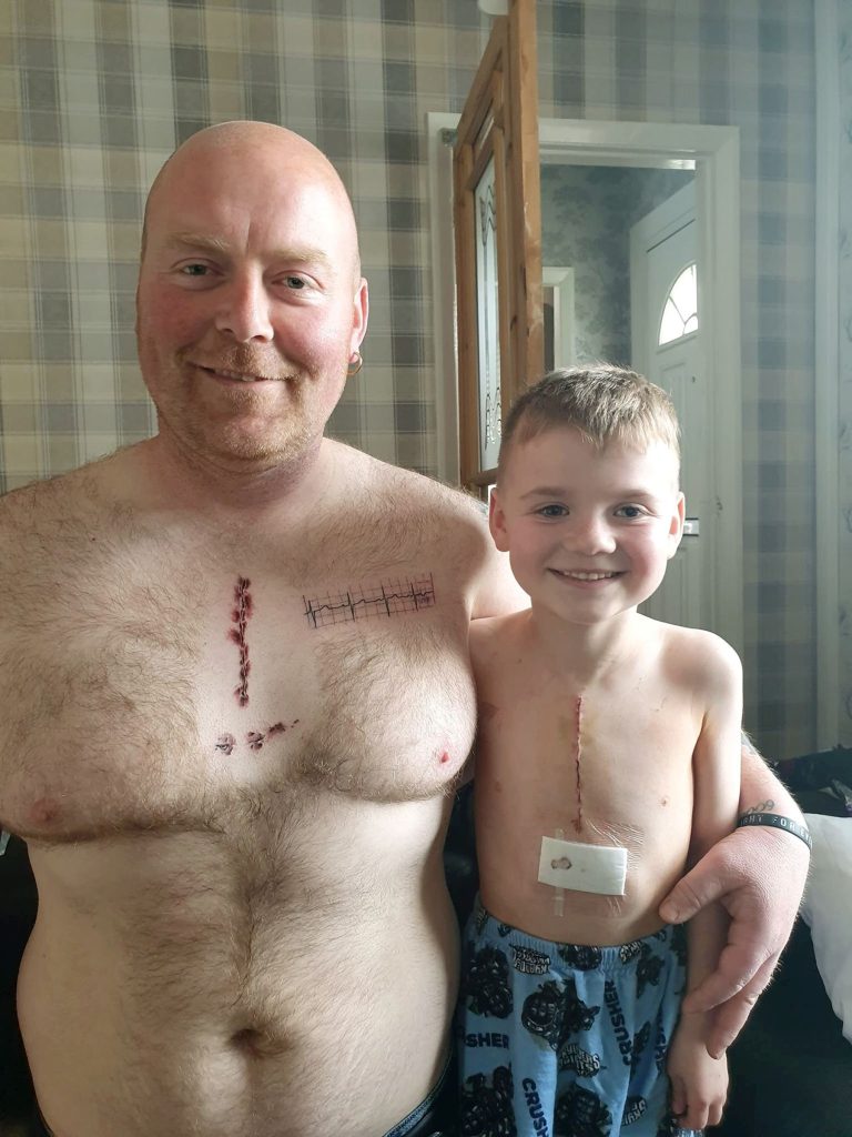 Ce papa se fait tatouer la même cicatrice que son petit garçon opéré du  coeur